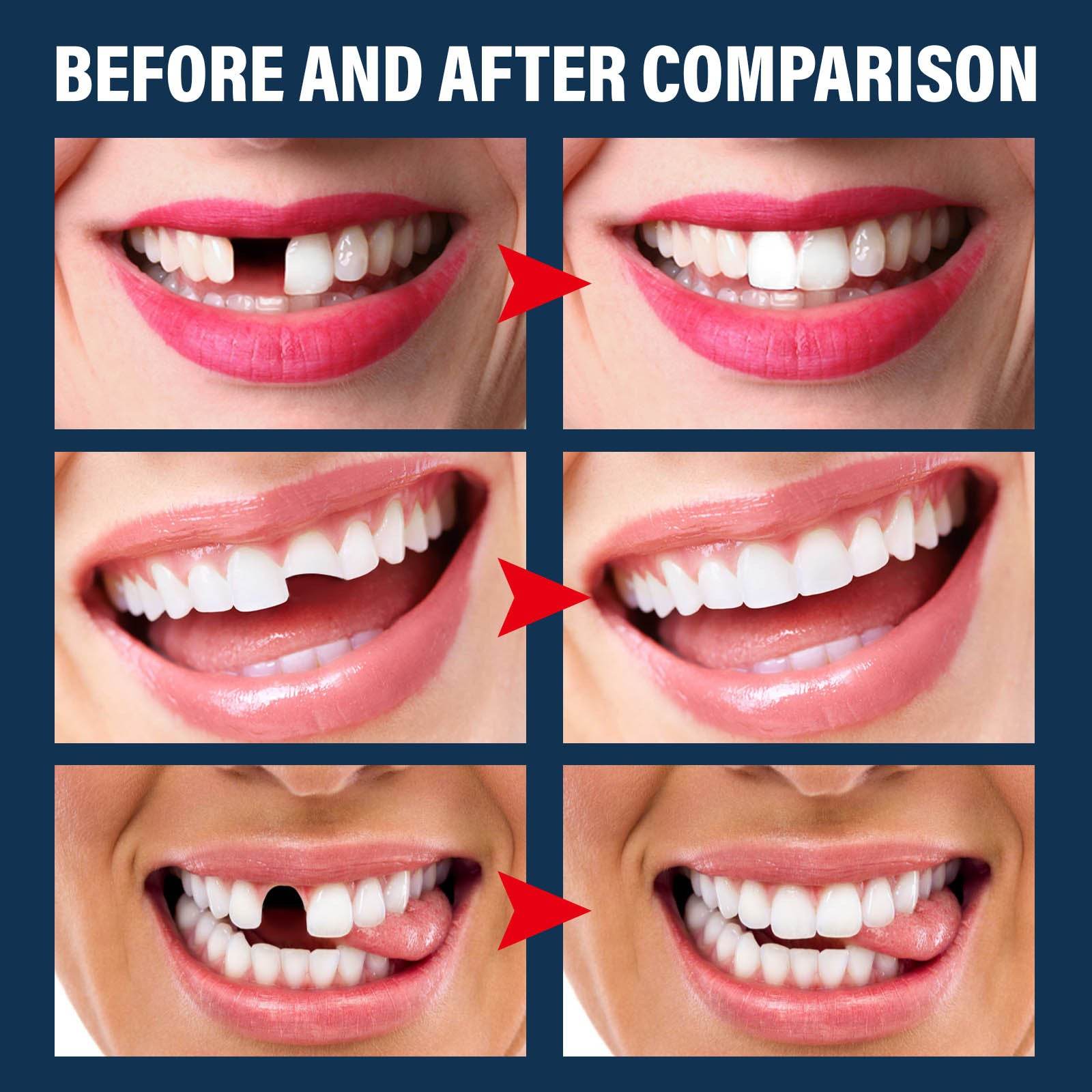 Denture Decorative Teether Set, Halloween Vampire Makeup Dress Up Fake Tooth Glue Teeth Props